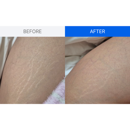 ILJAK Body Firming Cream