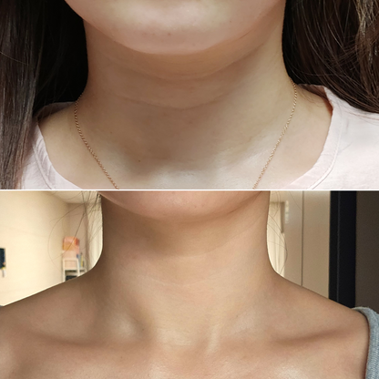 ILJAK Body Firming Cream