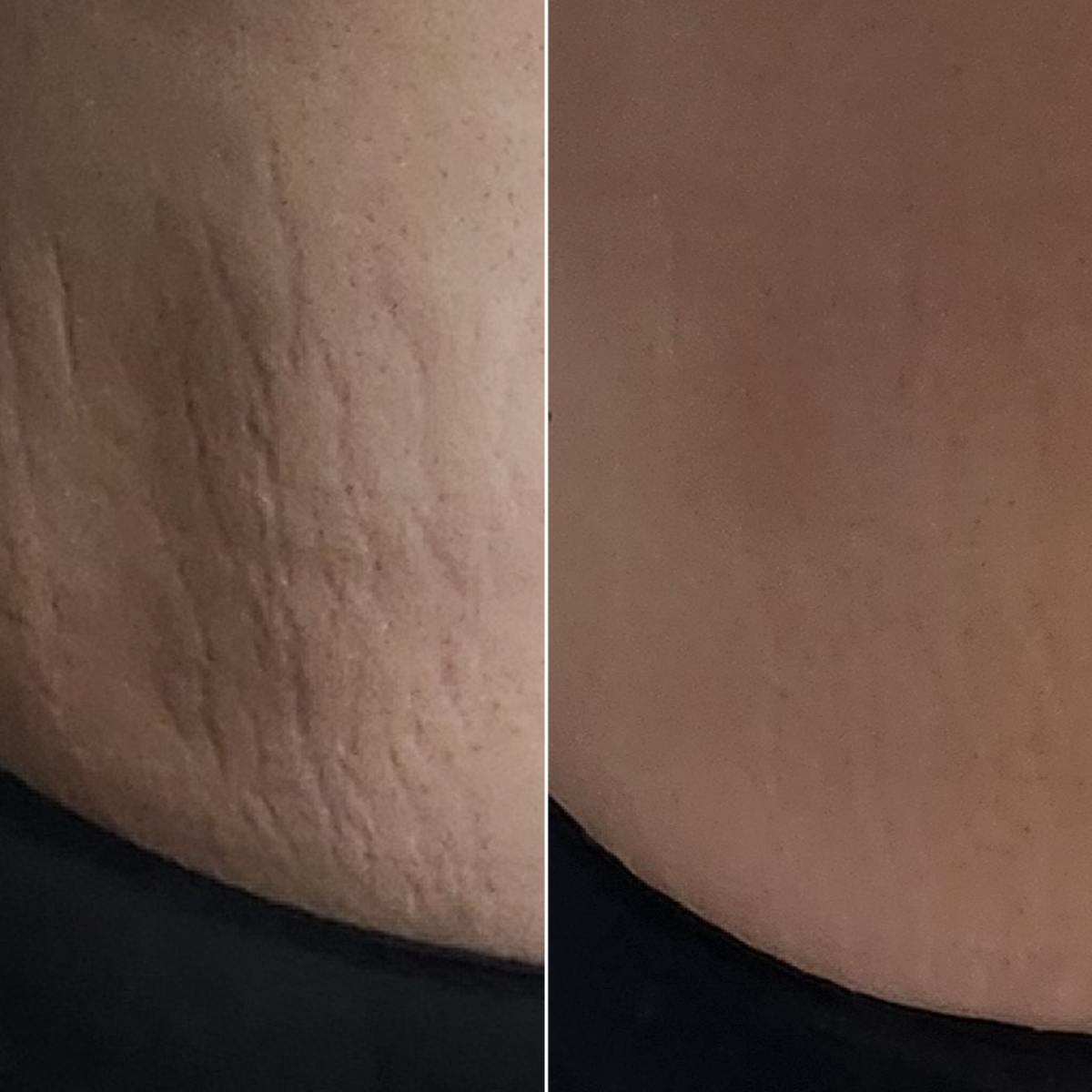 ILJAK Body Firming Cream