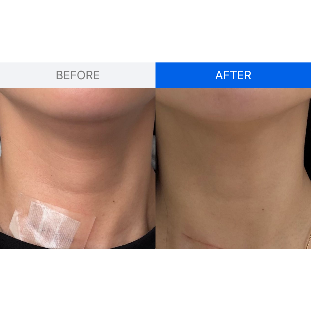 ILJAK Body Firming Cream