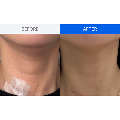 ILJAK Body Firming Cream