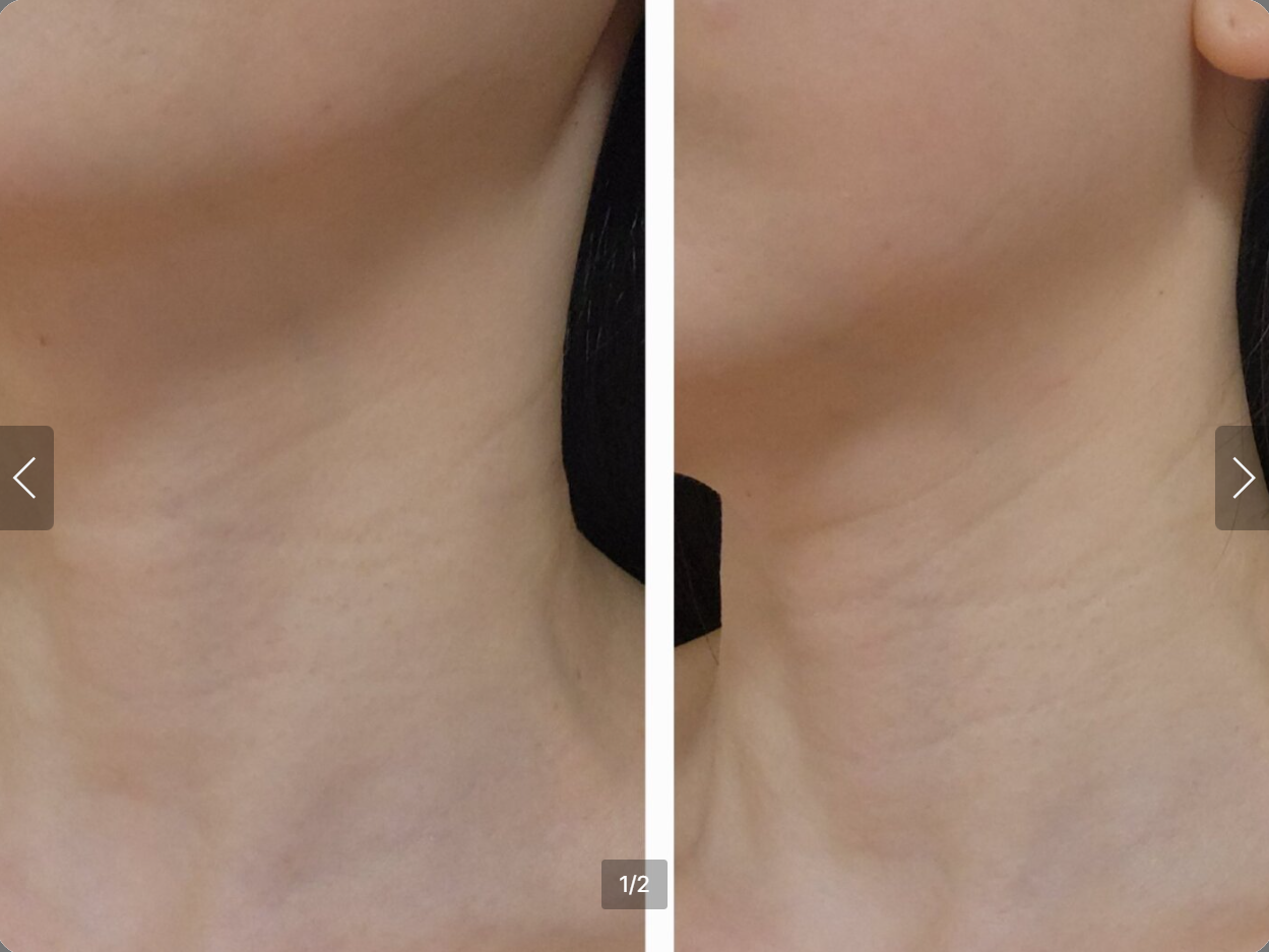 ILJAK Body Firming Cream