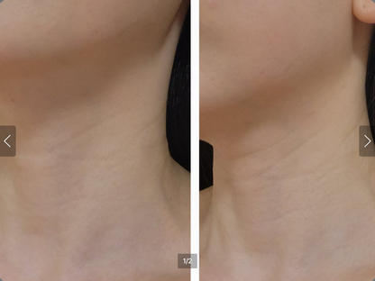 ILJAK Body Firming Cream
