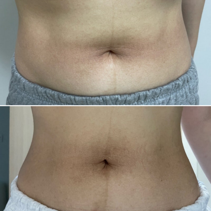 ILJAK Body Firming Cream