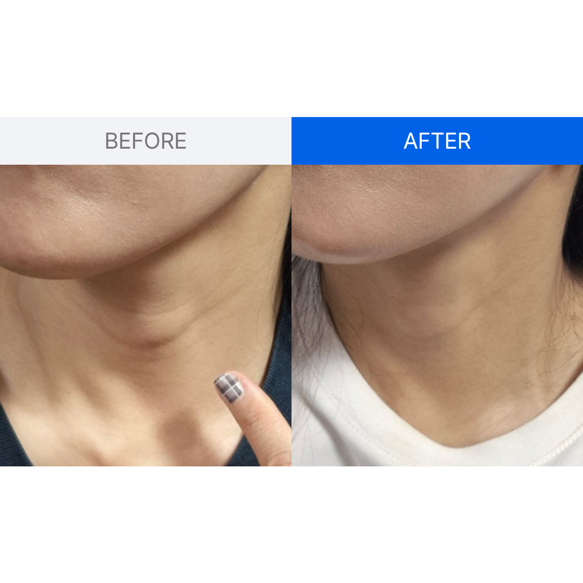 ILJAK Body Firming Cream