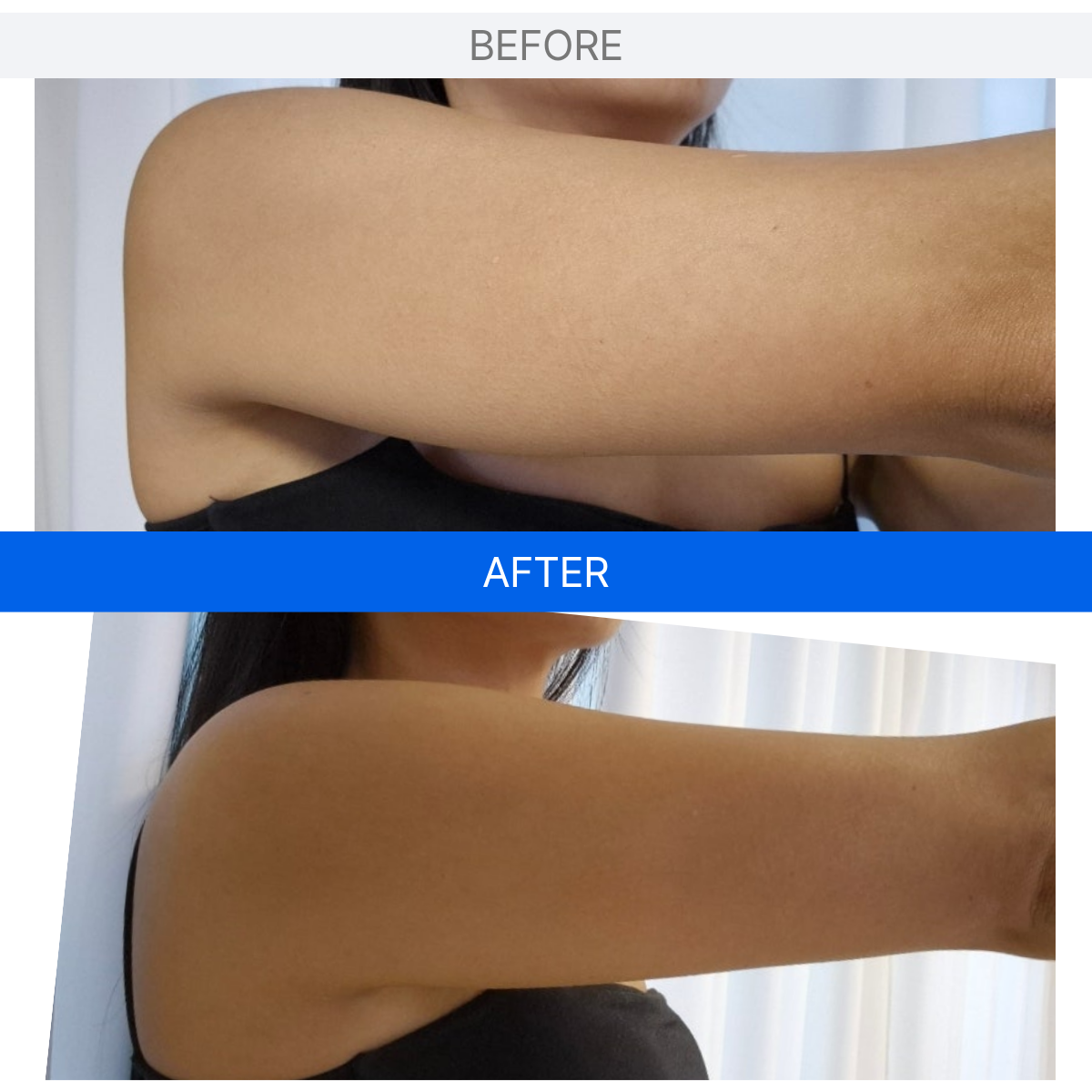 ILJAK Body Firming Cream