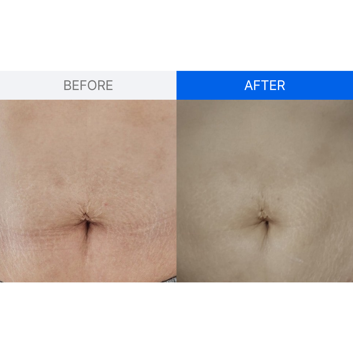 ILJAK Body Firming Cream