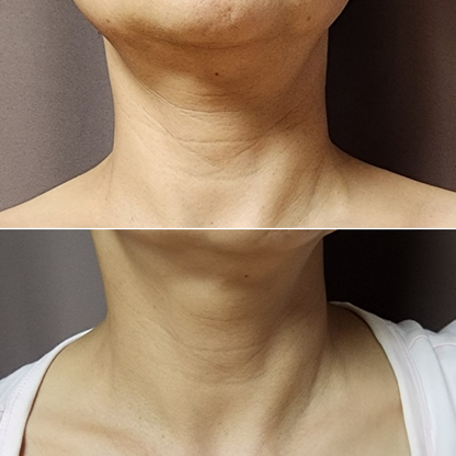 ILJAK Body Firming Cream