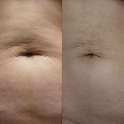 ILJAK Body Firming Cream