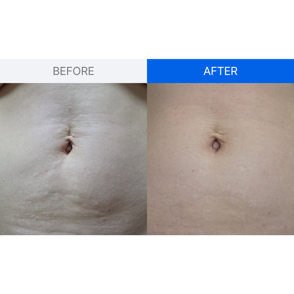 ILJAK Body Firming Cream